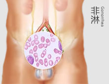 锦州仁德男科医院