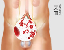 锦州仁德男科医院